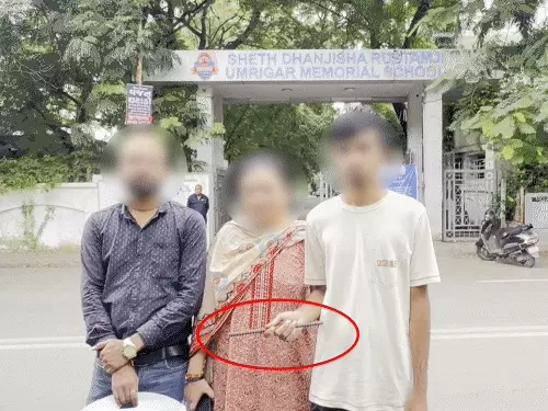 સુરત: શેઠ ધનજીશા રૂસ્તમજી ઉમરીગર સ્કૂલના વિદ્યાર્થી પર સળિયા વડે હુમલો