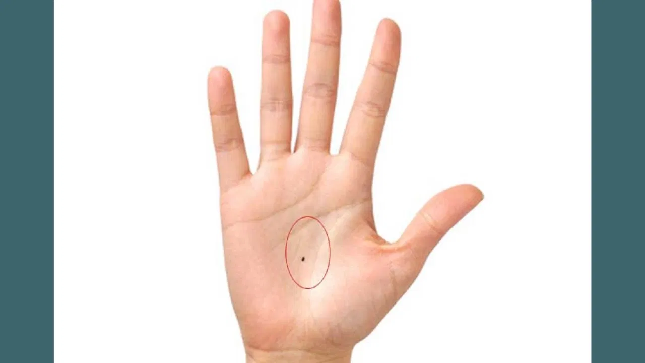 Moles on Hand: તમારા હાથની હથેળીના આ ભાગમાં તલનું હોવું..બનાવશે ધનવાન અને પૈસાની કમી નહીં રહે
