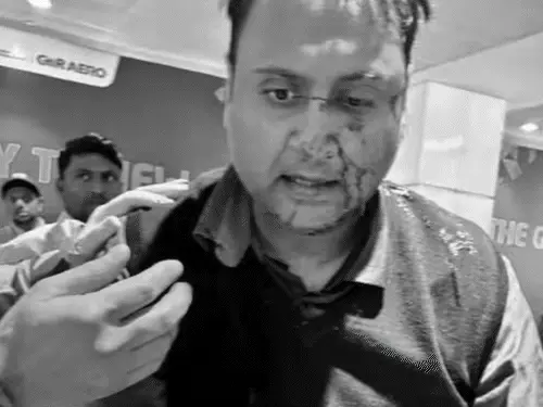 દિલ્હી એરપોર્ટ પર પાઇલટની ગુંડાગીરી:7 વર્ષની પુત્રી સામે પાઇલટે પેસેન્જર સાથે મારામારી કરી, લોહીથી લથપથ પિતાનો ચહેરો જોઈને દીકરી આઘાતમાં; પાઇલટ સસ્પેન્ડ